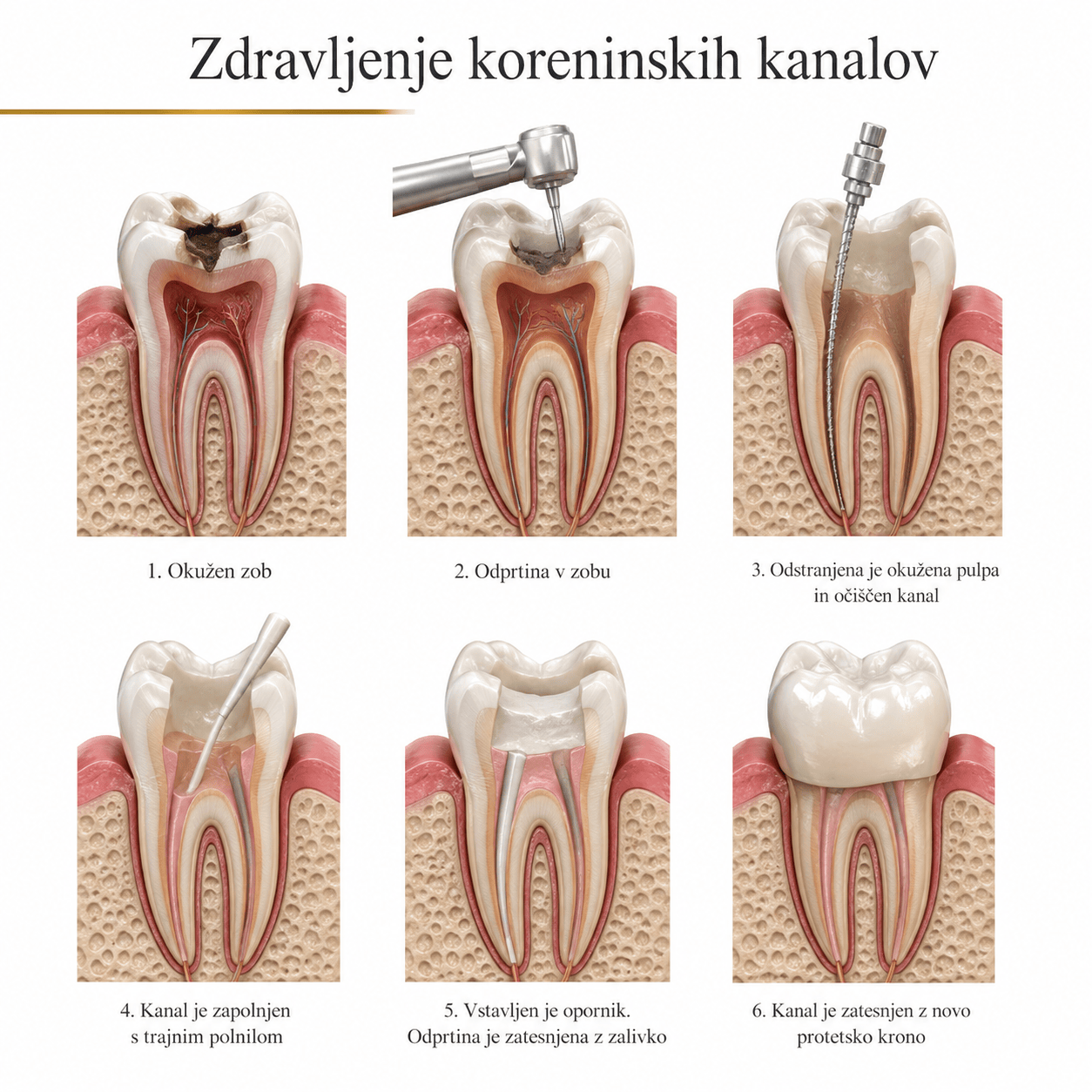 endo1